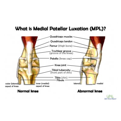 Click to enlarge: Patella anatomy