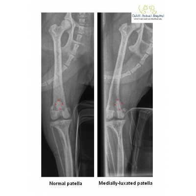 Click to enlarge: Patella xrays